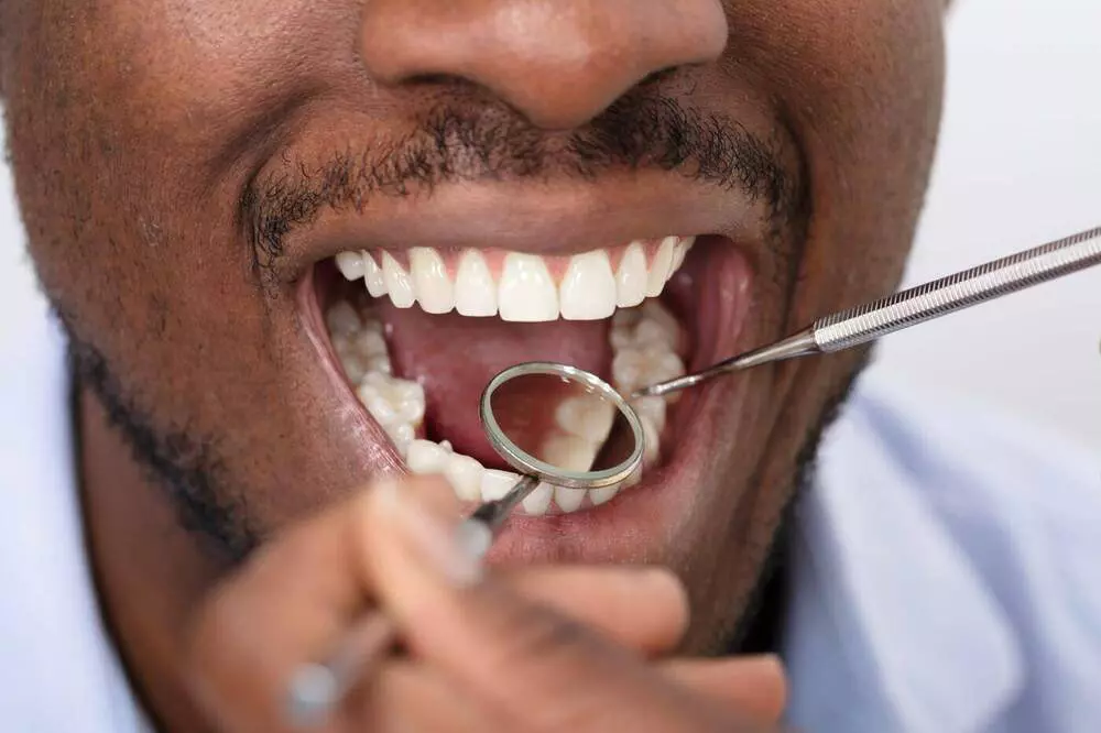 restorative-dentisrty