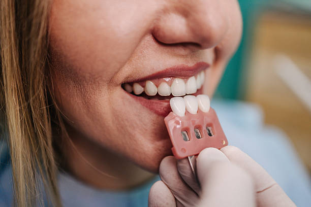 Dentist choosing shade of veneers for teeth whitening treatment